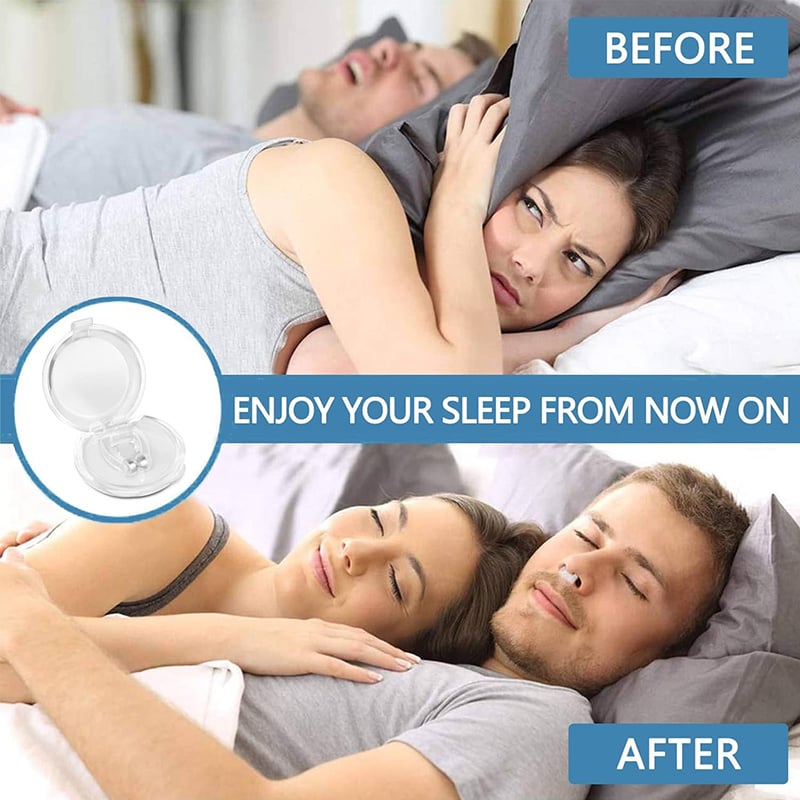 ✨2025 New Release -49% Off - Anti Snoring Devices Effective to Relieve Snoring 👃