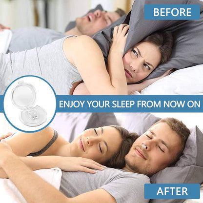✨2025 New Release -49% Off - Anti Snoring Devices Effective to Relieve Snoring 👃
