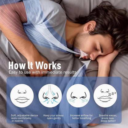 ✨2025 New Release -49% Off - Anti Snoring Devices Effective to Relieve Snoring 👃
